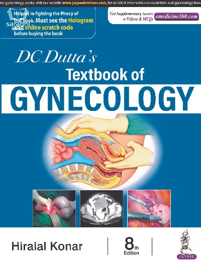 DC Dutta's Textbook of Gynecology  -  8th Edition